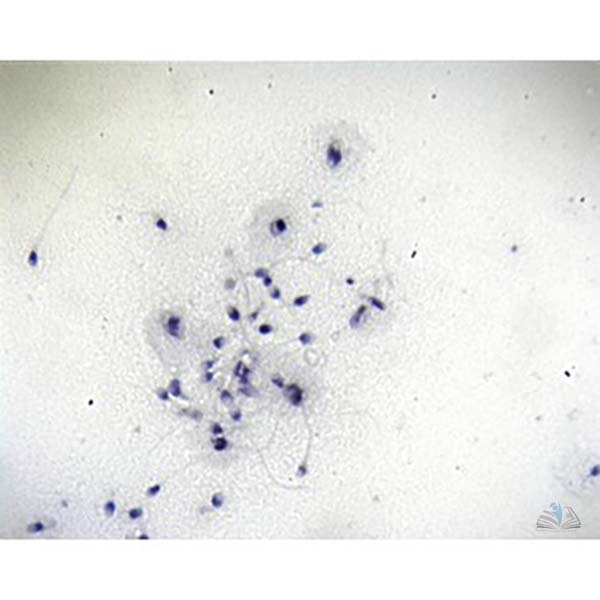 Prepared Microscope Slide - Human Spermatozoa Smear