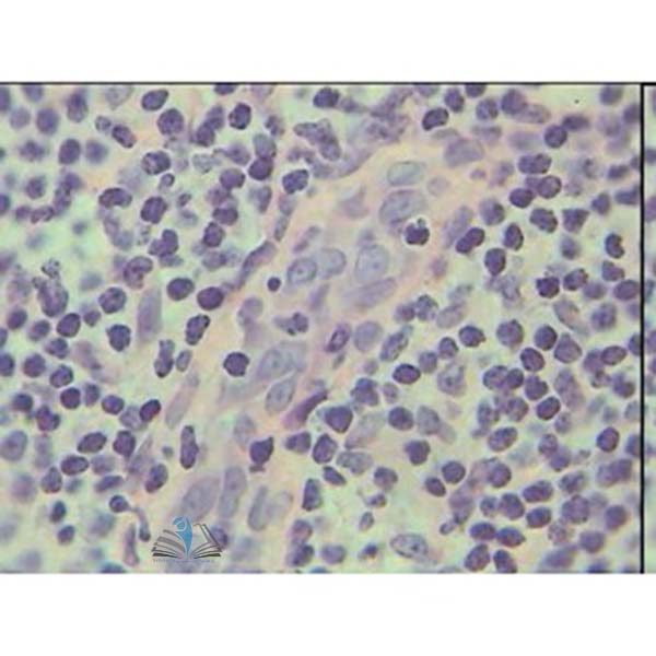 Prepared Microscope Slide - Human Thyroid Section