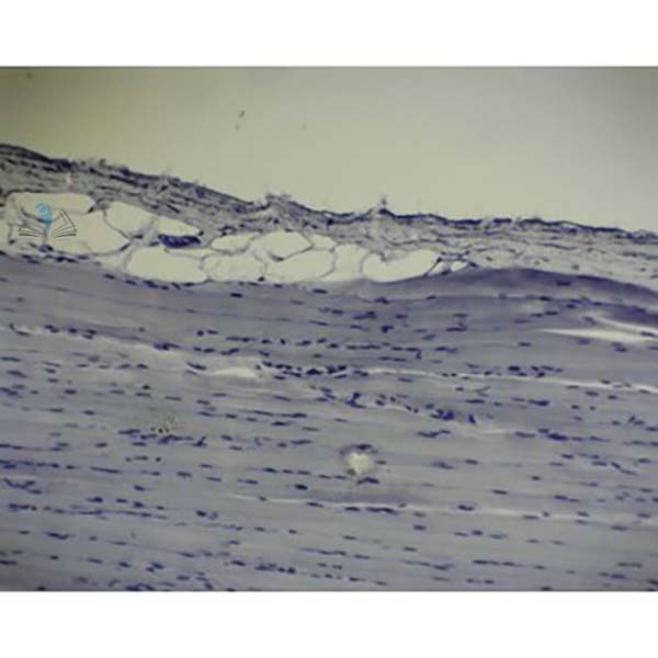 Prepared Microscope Slide - Striated Muscle Skeletal