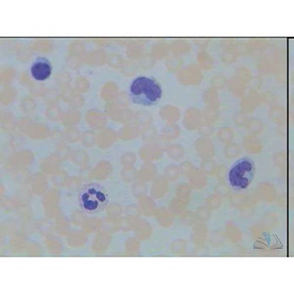 Prepared Microscope Slide - Liver Injected Section