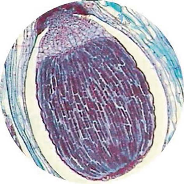 Prepared Microscope Slide - Club Moss (Mnium) Archegonial Head L.S.