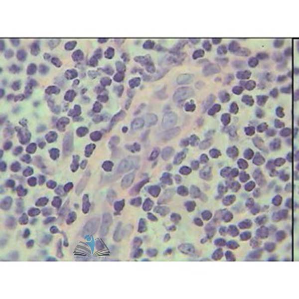 Prepared Microscope Slide - Thyroid Gland Section