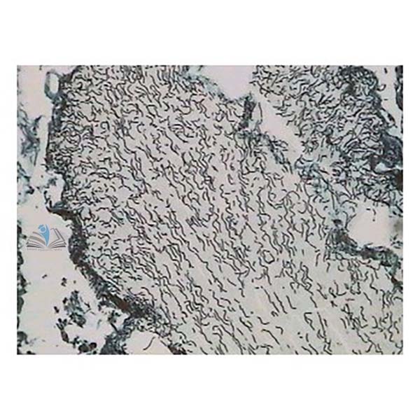 Prepared Microscope Slide - Nostoc Filament