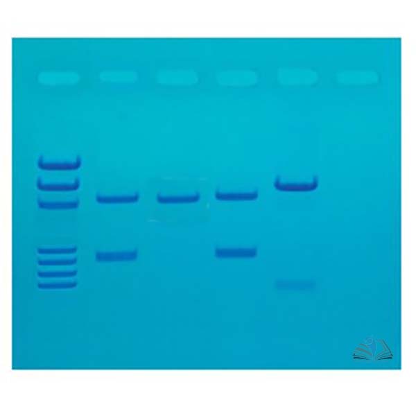 DNA Fingerprinting Made Simple Kit