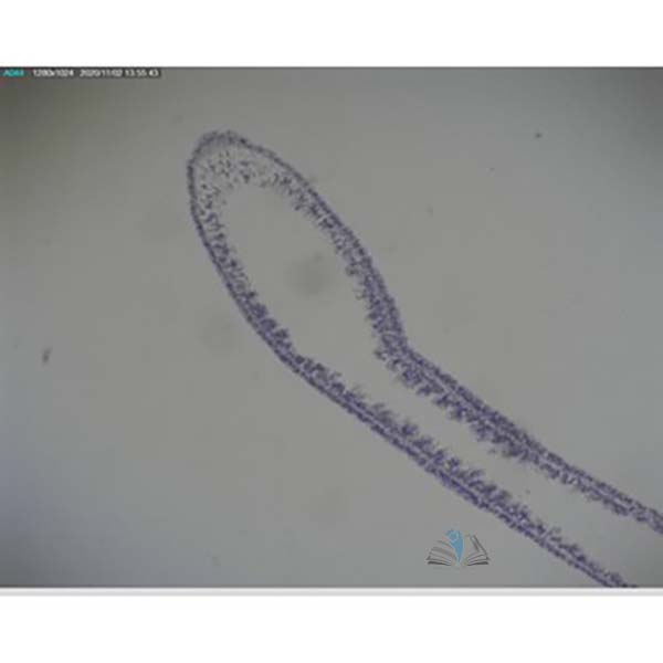 Prepared Microscope Slide - Hydra General Structure L.S.