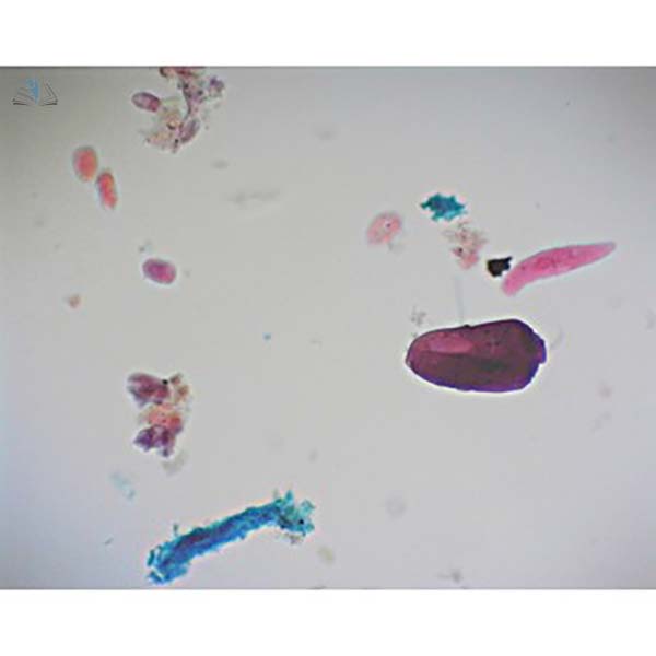 Prepared Microscope Slide - Mixed Protozoa W.M.