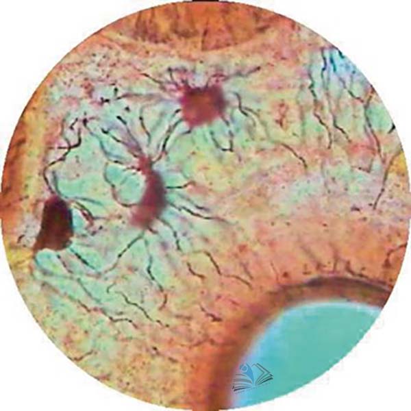 Prepared Microscope Slide - Joint for Articulation of Bones L.S.