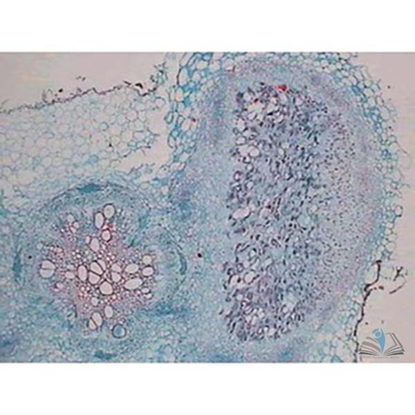 Prepared Microscope Slide - Rhizobium leguminosarum Section