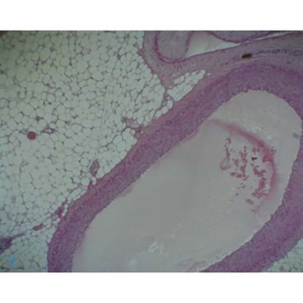 Prepared Microscope Slide - Aorta and Vein T.S.