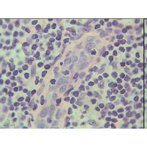 Prepared Microscope Slide - Adrenal Gland Cortex and Medulla T.S.