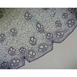 Prepared Microscope Slide - Monocot and Dicot Stem Comparison Slide T.S.