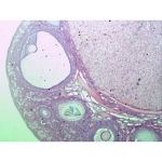 Basic Reproductive Slide Set