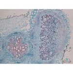 Prepared Microscope Slide - Rhizobium leguminosarum Section