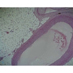 Prepared Microscope Slide - Aorta and Vein T.S.