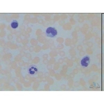 Prepared Microscope Slide - Liver Injected Section