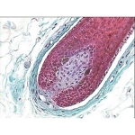 Prepared Microscope Slide - Human Scalp V.S.